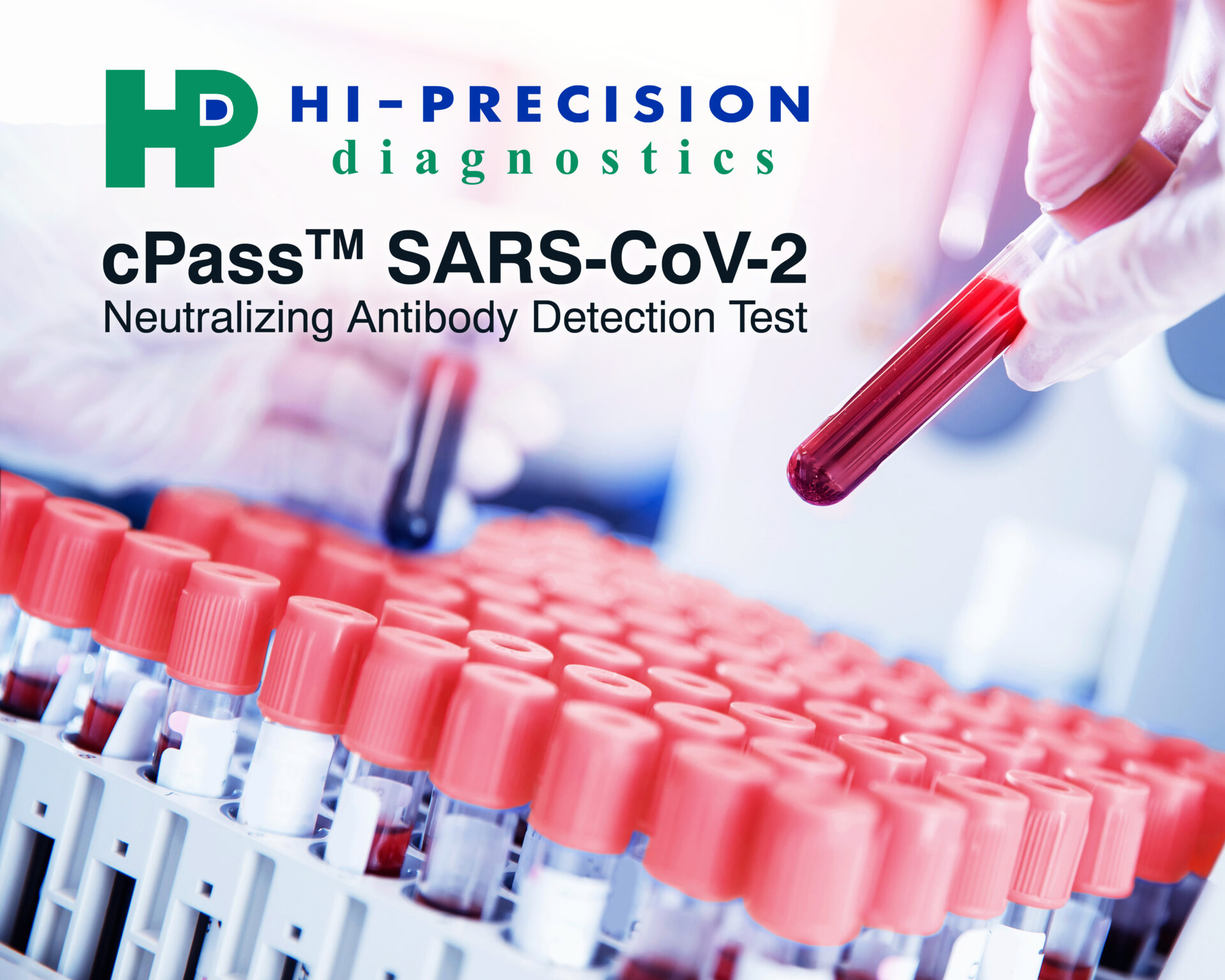 Lab,Worker,Preparing,Test,Blood,For,Detection,Of,Antibodies,And