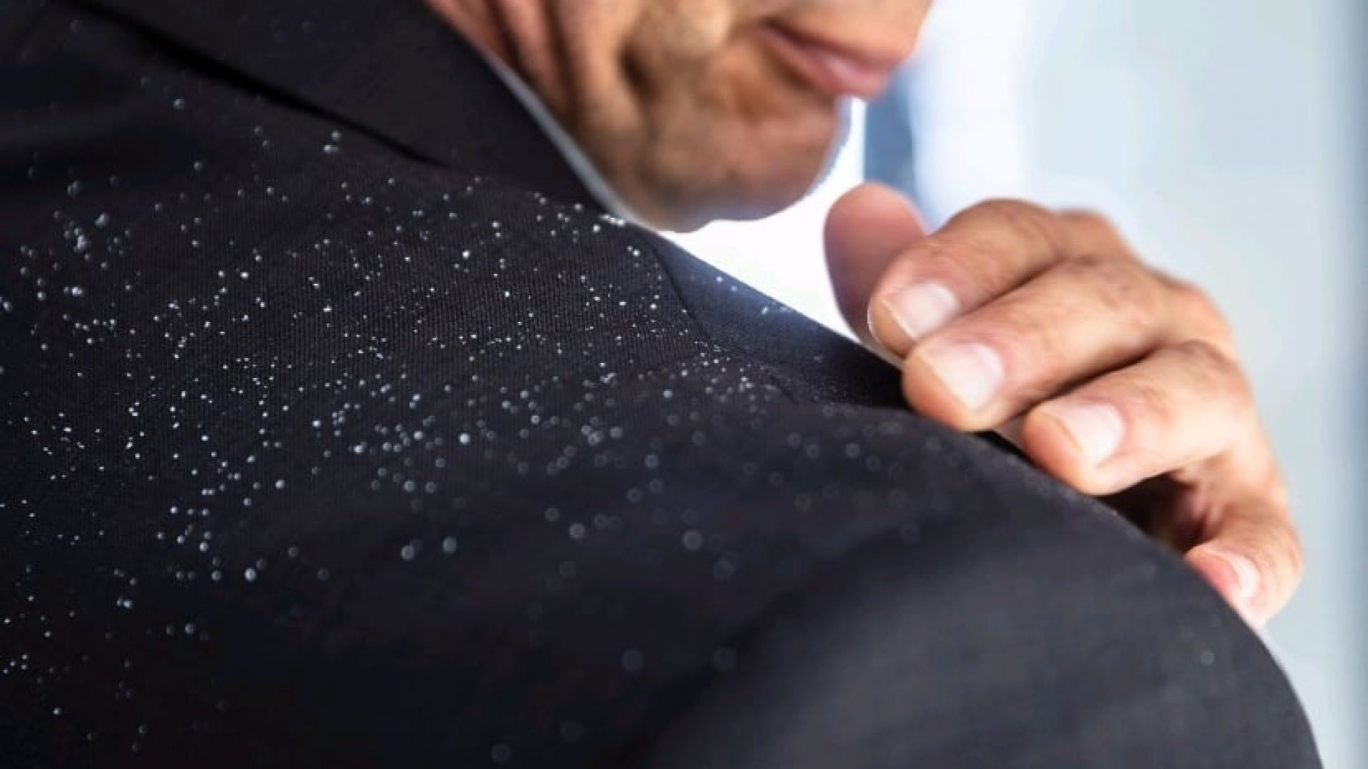 The biggest reality today, DANDRUFF worsens during the rainy season